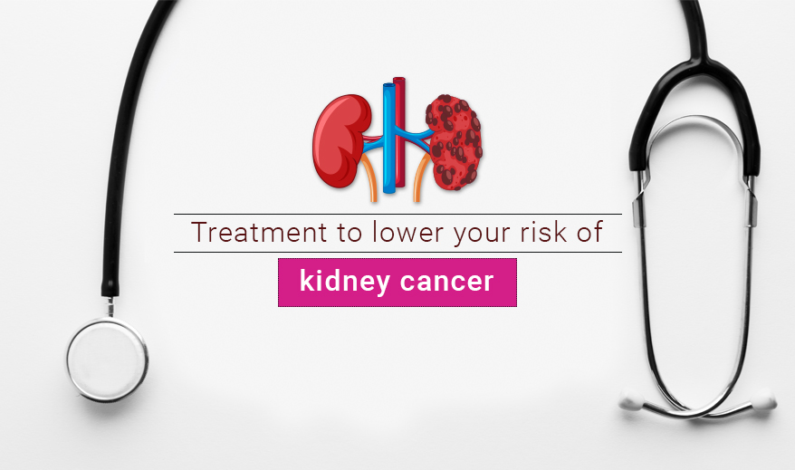treatment to lower your risk of kidney cancer
